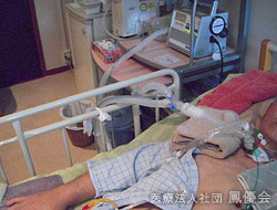 人工呼吸器 イメージ2