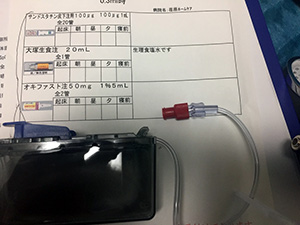 第35夜　腹膜播種（ふくまくはしゅ）について